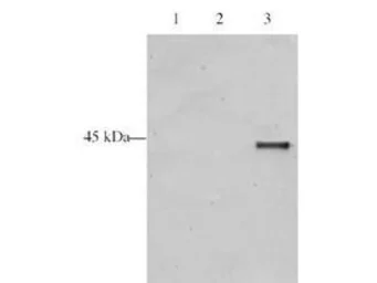 Anti-ING5 antibody used in Western Blot (WB). GTX48484