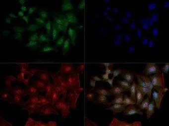 Anti-DNMT1 antibody [60B1220.1] used in Immunocytochemistry/ Immunofluorescence (ICC/IF). GTX48548
