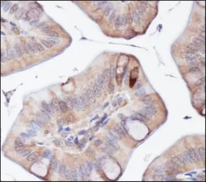 Anti-ATG5 antibody used in IHC (Paraffin sections) (IHC-P). GTX48583