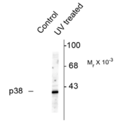 Anti-p38 MAPK (phospho Thr180/Tyr182) antibody used in Western Blot (WB). GTX48614