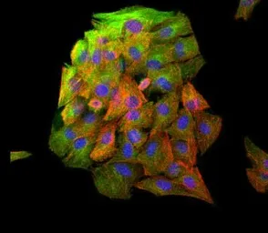 Anti-beta Tubulin antibody used in Immunocytochemistry/ Immunofluorescence (ICC/IF). GTX48617