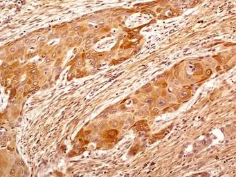 Anti-beta Tubulin antibody used in IHC (Paraffin sections) (IHC-P). GTX48617