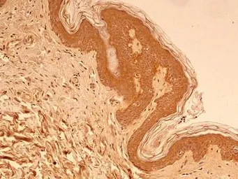 Anti-beta Tubulin antibody used in IHC (Paraffin sections) (IHC-P). GTX48617
