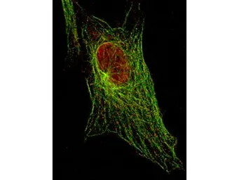 Anti-STAT5A (phospho Tyr694) antibody [5F6.F1] used in Immunocytochemistry/ Immunofluorescence (ICC/IF). GTX48647