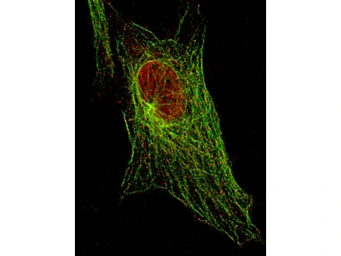 Anti-STAT5A (phospho Tyr694) antibody [5F6.F1] used in Immunocytochemistry/ Immunofluorescence (ICC/IF). GTX48647