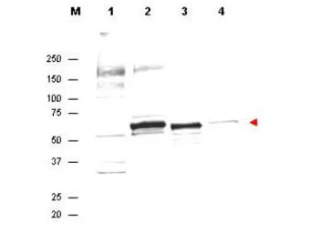 Anti-AKT antibody used in Western Blot (WB). GTX48651