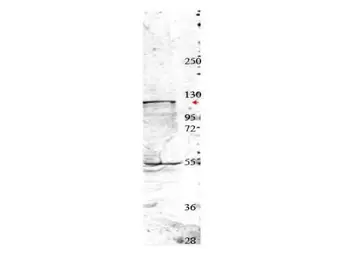 Anti-NEDD4 antibody used in Western Blot (WB). GTX48706