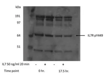 Anti-IL7 Receptor alpha (phospho Tyr449) antibody used in Western Blot (WB). GTX48714