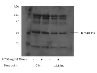Anti-IL7 Receptor alpha (phospho Tyr449) antibody used in Western Blot (WB). GTX48714