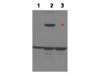 Anti-ASPP1 antibody used in Western Blot (WB). GTX48719
