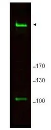 Anti-RIF1 antibody used in Western Blot (WB). GTX48737