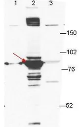Anti-ESRP1 antibody [27H12] used in Western Blot (WB). GTX48761
