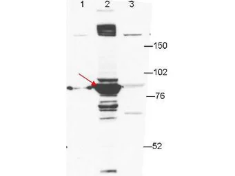 Anti-ESRP1 antibody [27H12] used in Western Blot (WB). GTX48761