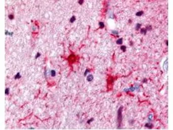 Anti-S100 antibody used in IHC (Paraffin sections) (IHC-P). GTX48819