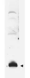 Anti-Sumo antibody used in Western Blot (WB). GTX48821