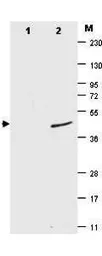 Anti-Sumo antibody [4F2.F5.G2] used in Western Blot (WB). GTX48824