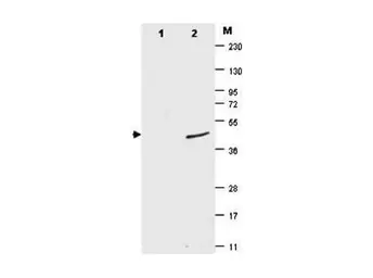Anti-Sumo antibody [4F2.F5.G2] used in Western Blot (WB). GTX48824