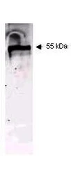 Anti-pan Cytokeratin antibody [C-11] used in Western Blot (WB). GTX48825