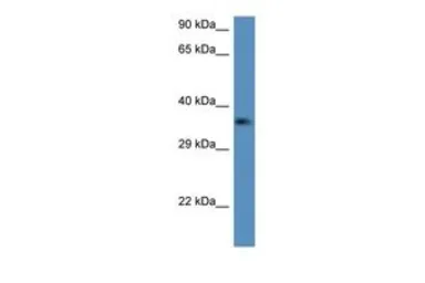 Anti-CTRP2 antibody, Internal used in Western Blot (WB). GTX48908