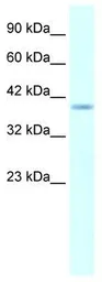 Anti-HMX1 antibody, Internal used in Western Blot (WB). GTX48949