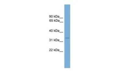 Anti-HOXB13 antibody, N-term used in Western Blot (WB). GTX48978