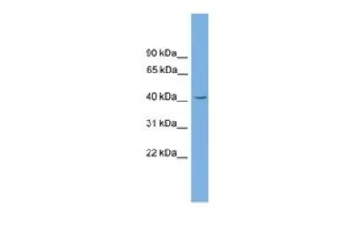 Anti-GATA5 antibody, N-term used in Western Blot (WB). GTX48995