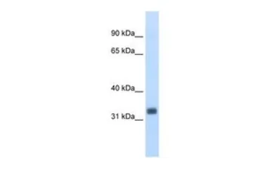 Anti-EHF antibody, N-term used in Western Blot (WB). GTX49008