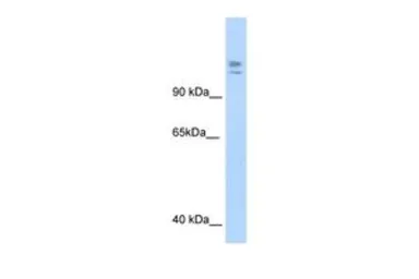Anti-MYBBP1A antibody, C-term used in Western Blot (WB). GTX49078