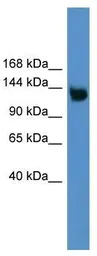 Anti-ApoER2 antibody, Internal used in Western Blot (WB). GTX49092