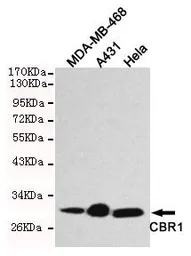 Anti-CBR1 antibody [2C9-B12-C4] used in Western Blot (WB). GTX49137
