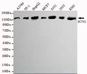 Anti-DCTN1 antibody [3D5-C6-D5] used in Western Blot (WB). GTX49164