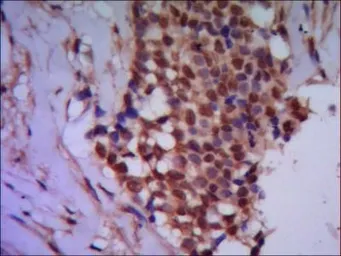 Anti-PPP4C antibody [2F11-D10-G4] used in IHC (Paraffin sections) (IHC-P). GTX49198
