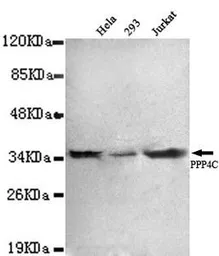 Anti-PPP4C antibody [2F11-D10-G4] used in Western Blot (WB). GTX49198