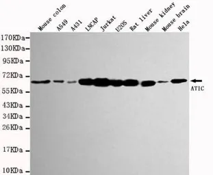 Anti-ATIC antibody [3H12-C9-H9] used in Western Blot (WB). GTX49205