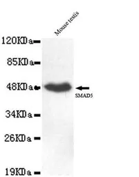Anti-SMAD5 antibody [4B10-B10-B6] used in Western Blot (WB). GTX49219