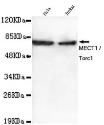 Anti-TORC1 antibody [3D7-E5-D9] used in Western Blot (WB). GTX49232
