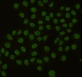 Anti-PCNA antibody [6B12-D7-H9] used in Immunocytochemistry/ Immunofluorescence (ICC/IF). GTX49256