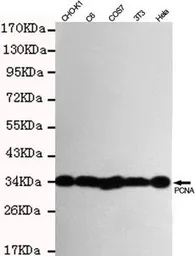 Anti-PCNA antibody [6B12-D7-H9] used in Western Blot (WB). GTX49256