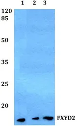 Anti-FXYD2 antibody used in Western Blot (WB). GTX49356