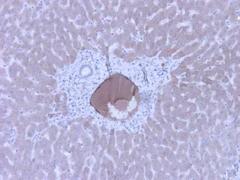Anti-C4C antibody [99-72-18] used in Immunohistochemistry (IHC). GTX49368