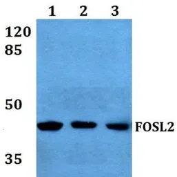 Anti-FRA2 antibody used in Western Blot (WB). GTX49376