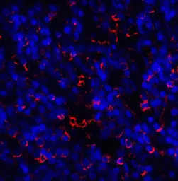 Anti-TIM-3 antibody used in IHC (Paraffin sections) (IHC-P). GTX49381