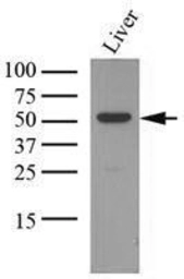Anti-OAT antibody [AT23A2] used in Western Blot (WB). GTX50004