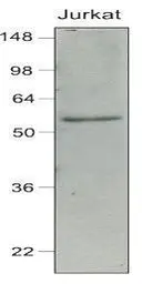 Anti-IRF7 antibody [3D9] used in Western Blot (WB). GTX50051