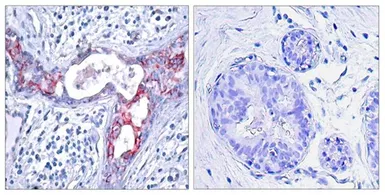 Anti-GSK3 beta (phospho Ser9) antibody used in IHC (Paraffin sections) (IHC-P). GTX50090
