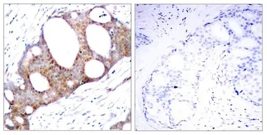 Anti-GSK3 alpha (phospho Ser21) antibody used in IHC (Paraffin sections) (IHC-P). GTX50095