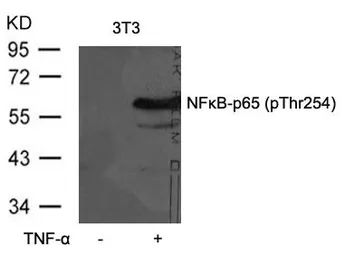 Anti-NFkB p65 (phospho Thr254) antibody used in Western Blot (WB). GTX50097