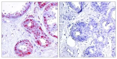Anti-c-Jun (phospho Ser243) antibody used in IHC (Paraffin sections) (IHC-P). GTX50104