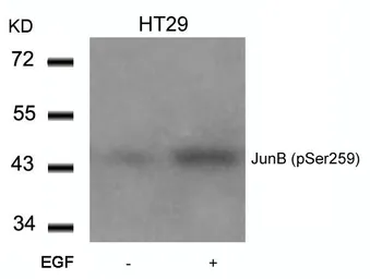 Anti-JunB (phospho Ser259) antibody used in Western Blot (WB). GTX50106