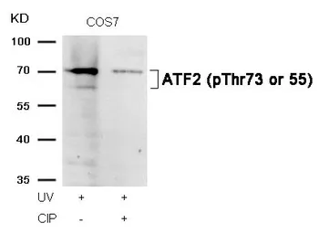 Anti-ATF2 (phospho Thr73) antibody used in Western Blot (WB). GTX50110